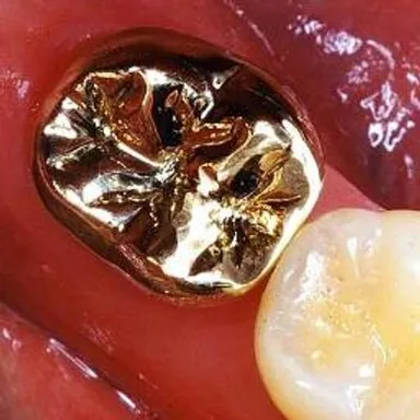 THEGOLDMOLAR